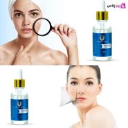 سرم لاکچری کوین ضد جوش