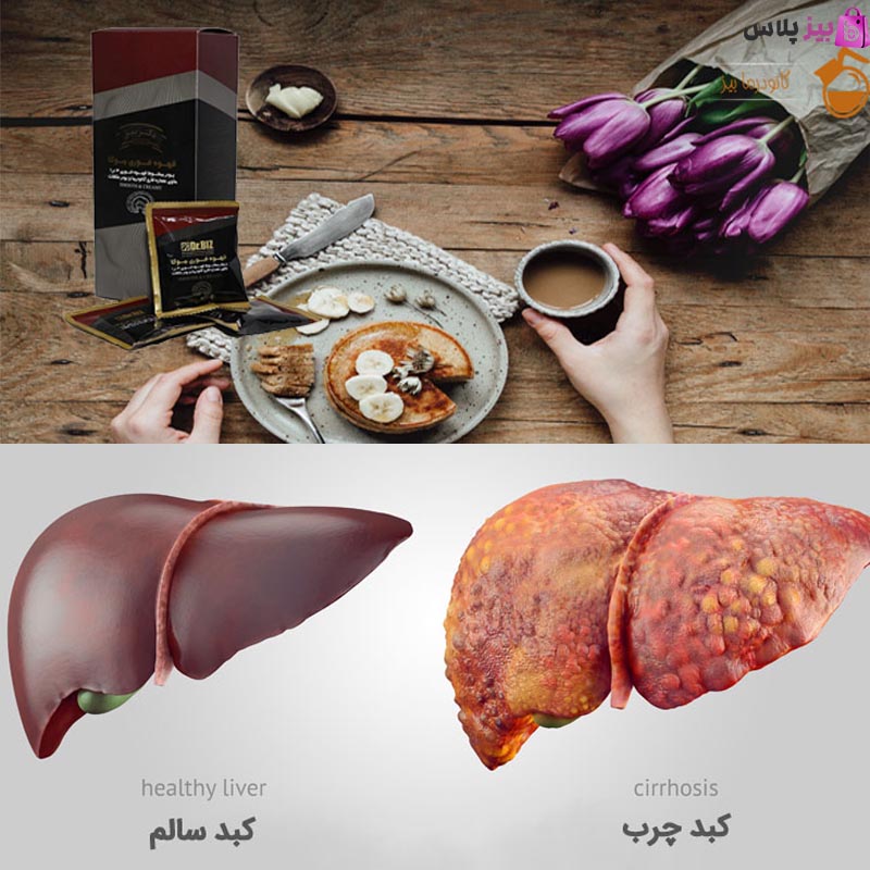 قهوه موکا گانودرما برای کبد چرب