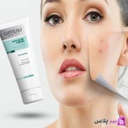 کرم ژل آنتی آکنه (ضدجوش و ضد لک) گاتیو