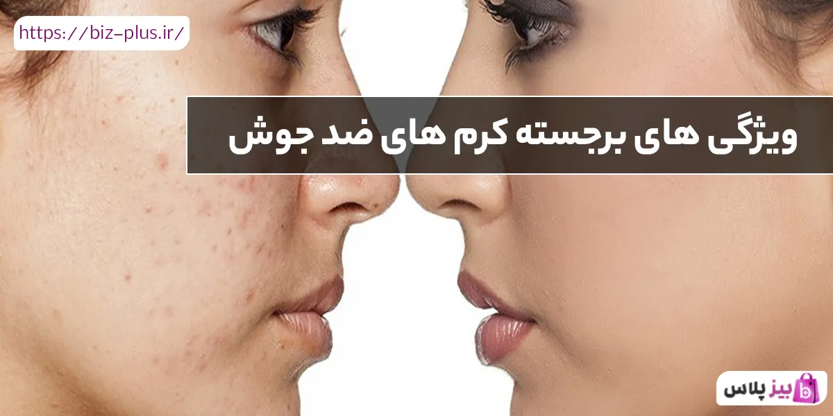 ویژگی های برجسته کرم های ضد جوش