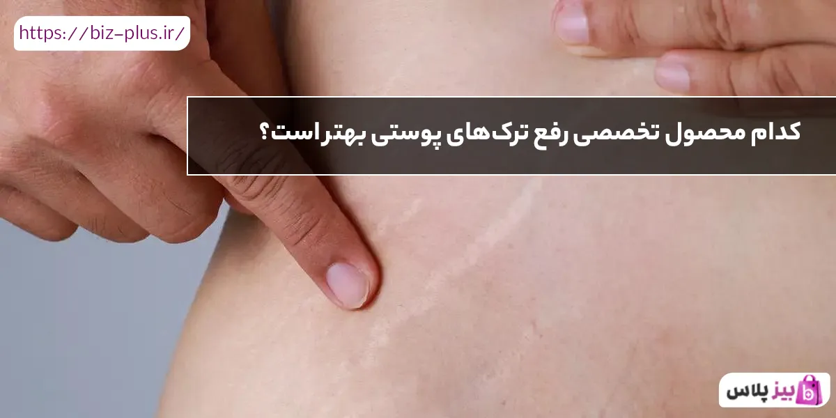 کدام محصول تخصصی رفع ترک‌های پوستی بهتر است؟